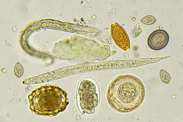 Microscopio muestra larvas y huevos de parásitos intestinales en perros. Se observan diferentes formas y tamaños, indicando posibles infestaciones.