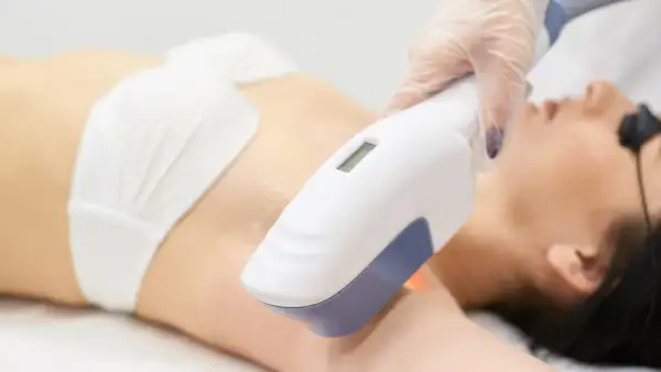 Depilacja laserowa bikini: co ile i ile zabiegów dla gładkiej skóry?