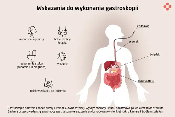 Objawy jak nudności, ból brzucha, wzdęcia, problemy z wypróżnianiem mogą sugerować potrzebę badania. Gastroskopia to metoda diagnostyczna co zamiast gastroskopii?