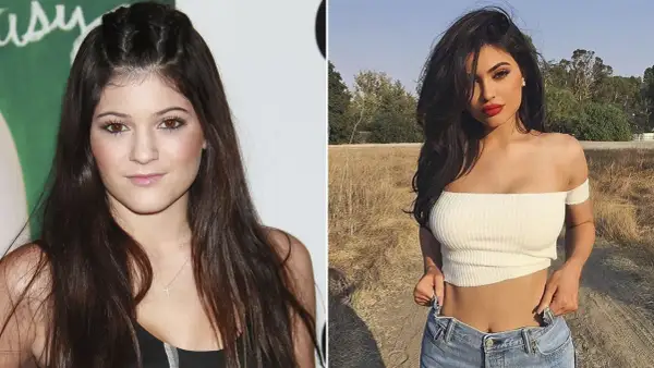Kylie Jenner antes y después: un vistazo a su transformación.