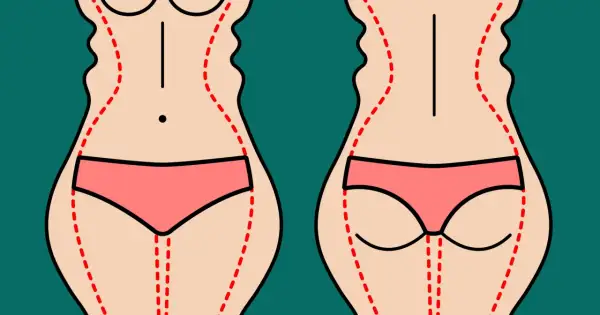 Przed i po liposukcji ultradźwiękowej: zarys sylwetki przed zabiegiem (falisty) i po (gładszy).