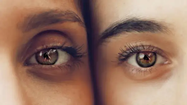 Primer plano de dos ojos, uno con ojeras marcadas, el otro con piel lisa.