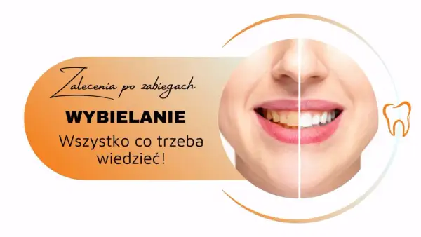 Zalecenia po zabiegach wybielania zębów. Uśmiech przed i po, by cieszyć się olśniewającą bielą.