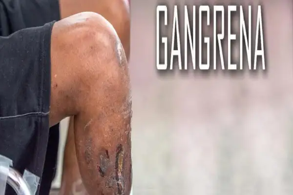 Fragment nogi z widocznymi ranami i tekstem "GANGRENA".
