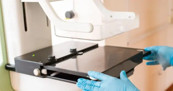 Ręce w niebieskich rękawiczkach przygotowują aparat do mammografii. Od ilu lat warto badać piersi?