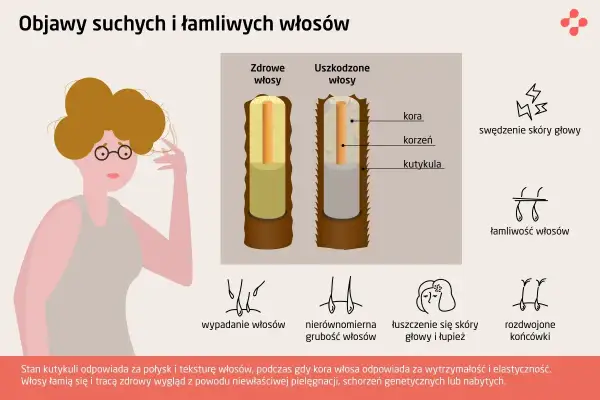 Ilustracja pokazuje porównanie zdrowych i uszkodzonych włosów, podkreślając problem łamliwości.