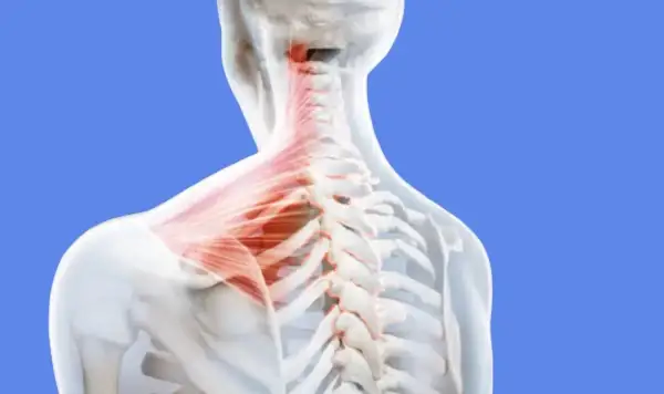 Vue anatomique du grand muscle du haut du dos, mettant en évidence la colonne vertébrale et les muscles du cou en rouge.