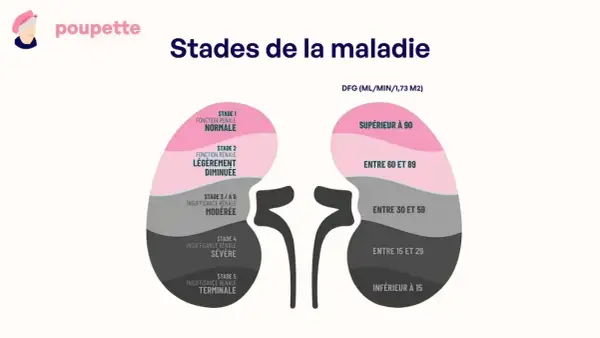 Schéma des stades de la maladie rénale, de la fonction normale à l'insuffisance terminale. Un taux de créatinine haut peut indiquer ces stades avancés.