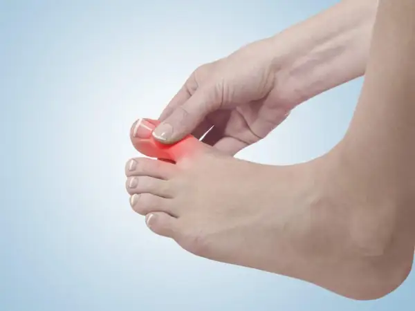 Schmerzender Zeh, möglicherweise durch Überlastung des extensor hallucis longus.