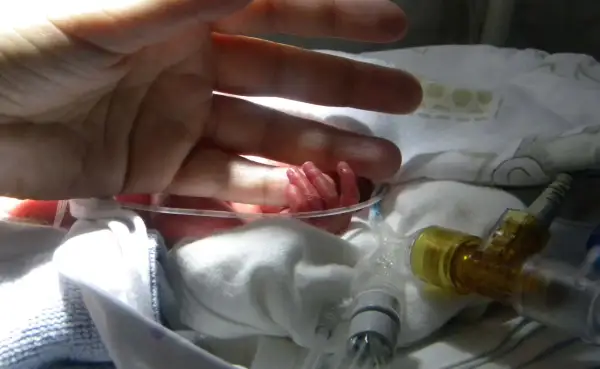 En vuxen hand vilar över en nyfödd bebis hand. Bebisens lilla hand ser ut att ha ett prematurt utseende, omgiven av medicinsk utrustning.