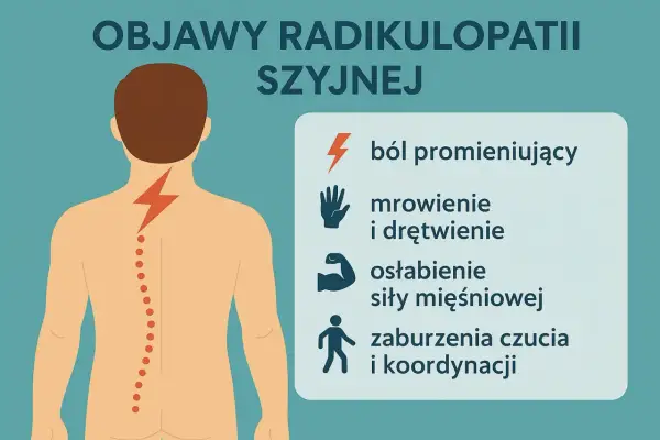 Ilustracja pokazuje objawy radikulopatii szyjnej: ból promieniujący, mrowienie, drętwienie, osłabienie mięśni i zaburzenia czucia. Odczuwasz ucisk w szyi? To może być jeden z objawów.