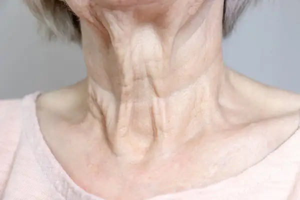 Primer plano del cuello de una mujer mayor, mostrando las arrugas del cuello y la piel con textura.
