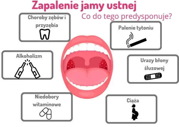 Ból w ustach? Zapalenie jamy ustnej objawy, rodzaje, pomoc