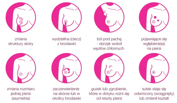 Osiem objawów raka piersi: zmiana struktury skóry, wydzielina z brodawki, ból pod pachą, wgłębienie, asymetria, zaczerwienienie, guzek, odwrócony sutek. Tu mammae dex to znaczy rak piersi.