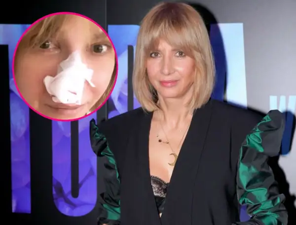 Grażyna Wolszczak po zabiegu. W okręgu zdjęcie z opatrunkiem na nosie, obok aktorka w eleganckiej kreacji.