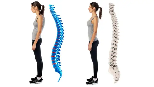 Postura scorretta e dolori addominali: confronto tra colonna vertebrale curva e dritta.