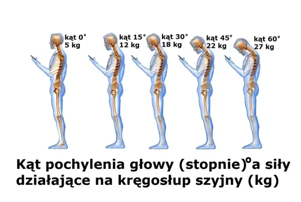 Schylanie się nad telefonem obciąża kręgosłup szyjny. Im większy kąt pochylenia głowy, tym większa siła działa na szyję.