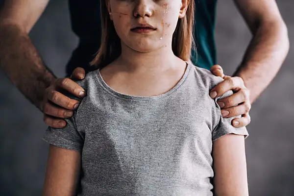 Zranione dziecko, łzy na twarzy. Dłoń na ramieniu. Jak udowodnić molestowanie po latach?