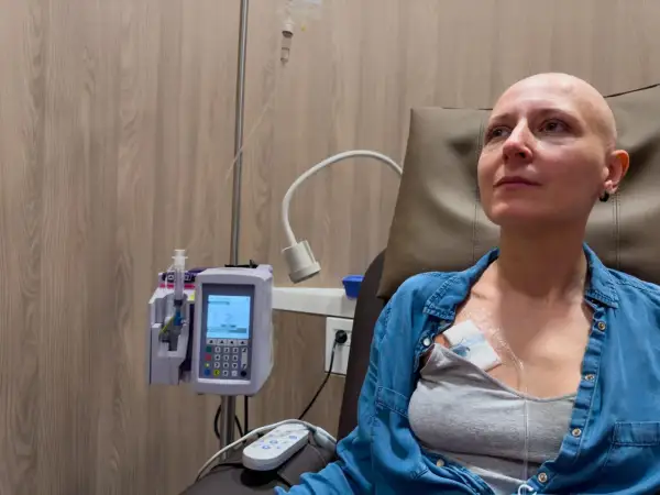 Kobieta po chemioterapii, która może być leczeniem raka jelita grubego. Przyczyny choroby są złożone.