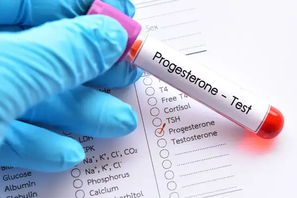 Rękawiczka trzyma probówkę z napisem "Progesteron - Test". Obok zaznaczono "Progesteron" na liście badań. Czy progesteron trzeba badać na czczo?