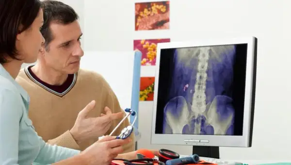 Medico e paziente esaminano una radiografia che mostra calcoli renali, possibile indicazione di malattia di Berger e potenziale invalidità.