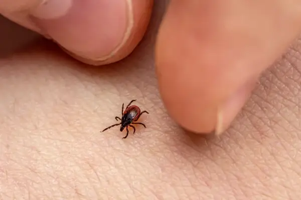 Cómo quitar garrapata de forma segura y evitar infecciones peligrosas