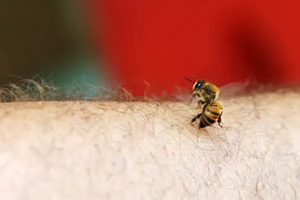 Jakie leki na użądlenie pszczoły? Szybka ulga i kiedy do lekarza?