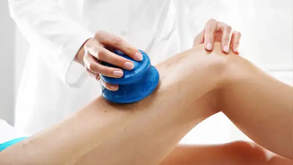 Masaż bańką chińską na udzie. Terapeuta wykonuje zabieg, przesuwając niebieską bańkę po skórze.