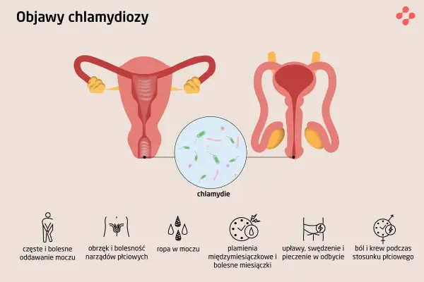 Ilustracja przedstawia układ rozrodczy kobiety i mężczyzny, powiększenie bakterii chlamydii oraz ikony symbolizujące objawy chlamydiozy: ból przy oddawaniu moczu, obrzęk narządów płciowych, ropę w moczu, plamienia, upławy, swędzenie i ból podczas stosu...