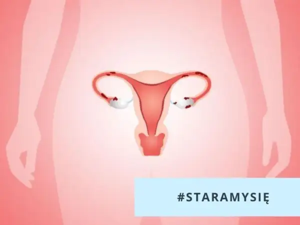 Ilustracja przedstawia tyłozgięcie macicy, które może wpływać na starania o dziecko.