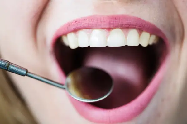 Usta z różową szminką, białe zęby i lusterko dentystyczne. Czy to początek leczenia zatrucia zęba na 3 miesiące?
