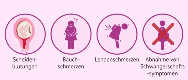 Anzeichen einer Fehlgeburt in der 17. SSW: Blutungen, Bauchschmerzen, Rückenschmerzen, Abnahme von Schwangerschaftssymptomen.