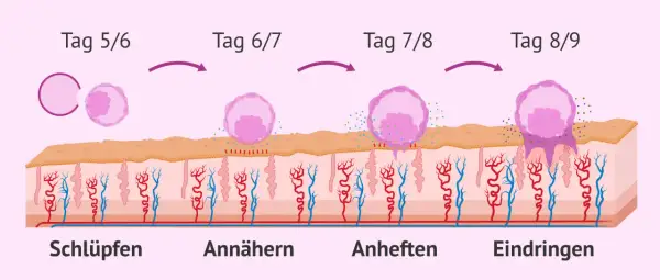 Was passiert nach dem Eisprung: Ein Embryo schlüpft, nähert sich, heftet sich an und dringt in die Gebärmutterschleimhaut ein.