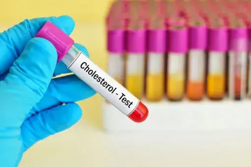 Cholesterol 200 czy to dużo? Sprawdź, co to oznacza dla zdrowia