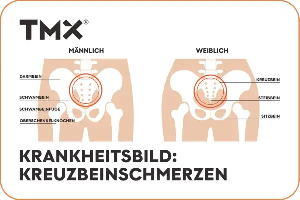 Vergleich männliches und weibliches Becken mit Hervorhebung des os sacrum. Illustration von Kreuzbeinschmerzen.