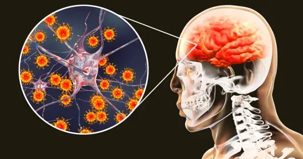 Ilustracja przedstawia wirusy atakujące neuron, co może prowadzić do kleszczowego zapalenia mózgu. Widoczny jest również przekrój głowy z mózgiem.
