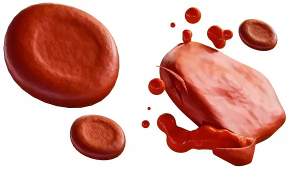 Czerwone krwinki, jedna z nich pęka, uwalniając zawartość. To obraz hemolizy, rozpadu komórek krwi.