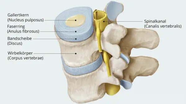 Anatomische Darstellung: wo ist die bandscheibe? Sie besteht aus Gallertkern und Faserring, eingebettet zwischen Wirbelkörpern. Der Spinalkanal verläuft dahinter.