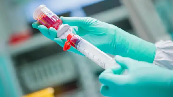 Hände in grünen Handschuhen ziehen rote Flüssigkeit aus einer Ampulle in eine große Spritze. Eine Chemotherapie-Spritze wird vorbereitet.