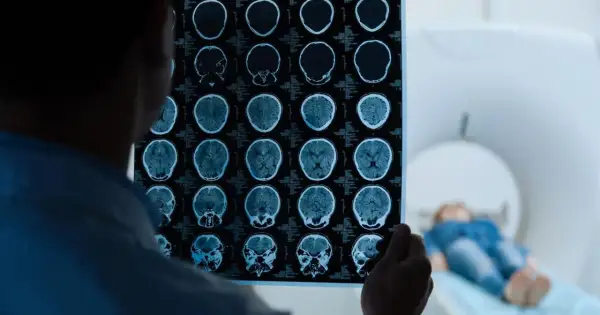 Lekarz analizuje wyniki rezonansu magnetycznego głowy, wykonanego w ramach testu na wstrząs mózgu. W tle pacjent leży w aparacie MRI.