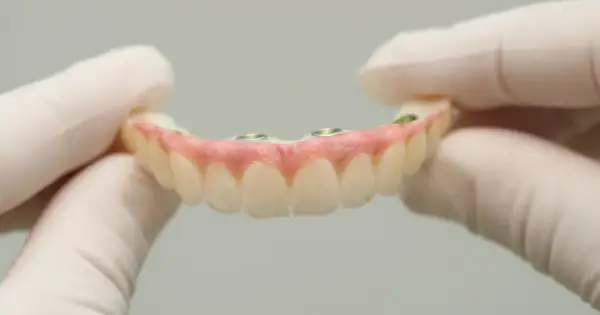 Dłonie w rękawiczkach trzymają protezę zębową na implantach. Dofinansowanie do protezy zębowej może pomóc w odzyskaniu pięknego uśmiechu.