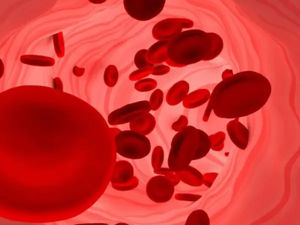 Czerwone krwinki płynące w naczyniu krwionośnym. Duża ilość erytrocytów może sugerować podwyższona hemoglobina.