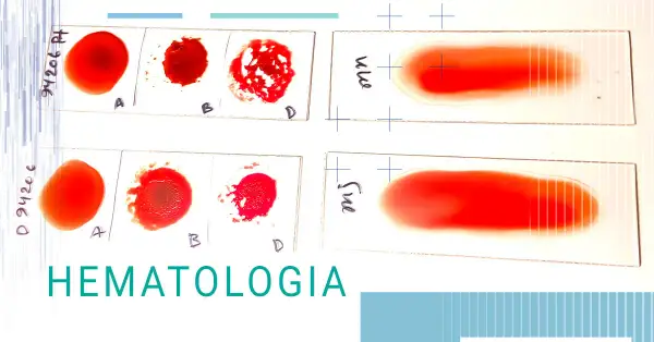 Zaburzenia hematologiczne co to - objawy, przyczyny i leczenie