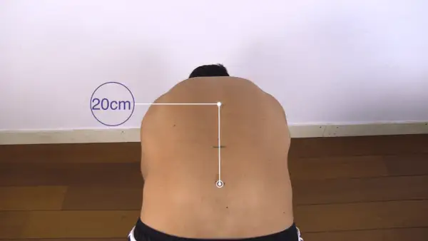 Pomiar zakresu ruchu kręgosłupa, znany jako objaw Schobera, pokazuje 20 cm rozciągnięcia.