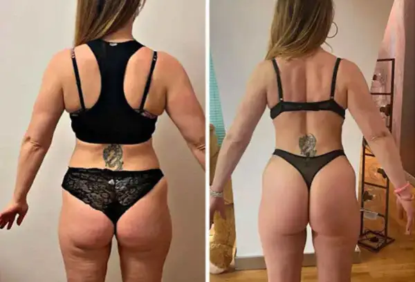 Prima e dopo: la trasformazione di una donna con glutei perfetti, più tonici e scolpiti.