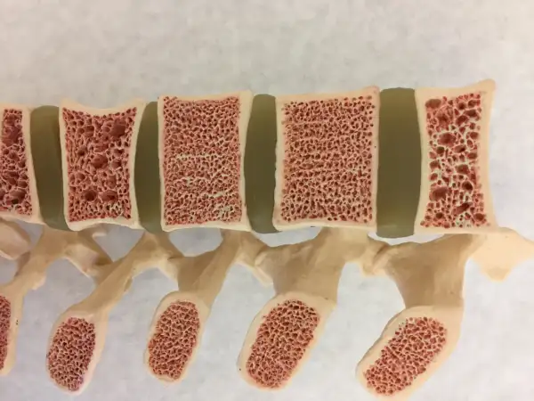Model kręgosłupa z widocznym przekrojem kości, ukazującym gąbczastą strukturę. Widać liczne pory wewnątrz **bonevum**, co przypomina plaster miodu.