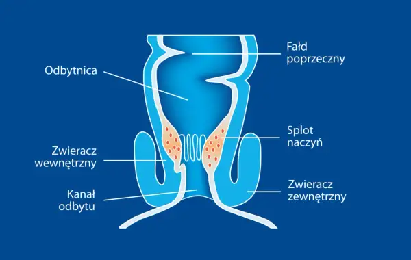 Schemat budowy odbytnicy z zaznaczonym splotem naczyń, który może być przyczyną hemoroidów.