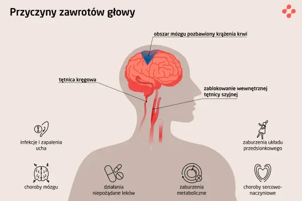 Gdy kręci się w głowie, przyczyną może być blokada tętnicy szyjnej, problemy z krążeniem mózgu, choroby ucha, mózgu, metaboliczne, sercowo-naczyniowe lub leki.