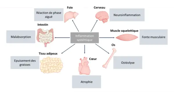 Schéma montrant l'inflammation systémique affectant le muscle squelettique, entraînant une fonte musculaire. D'autres effets incluent le cerveau, le foie, le cœur, les os, l'intestin, le tissu adipeux et la réaction de phase aiguë.