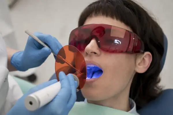 Pacjentka w okularach ochronnych poddaje się zabiegowi stomatologicznemu. Dentysta używa lampy polimeryzacyjnej, która emituje niebieskie światło. Po piaskowaniu zębów, taka kawa z mlekiem smakuje jak nagroda.